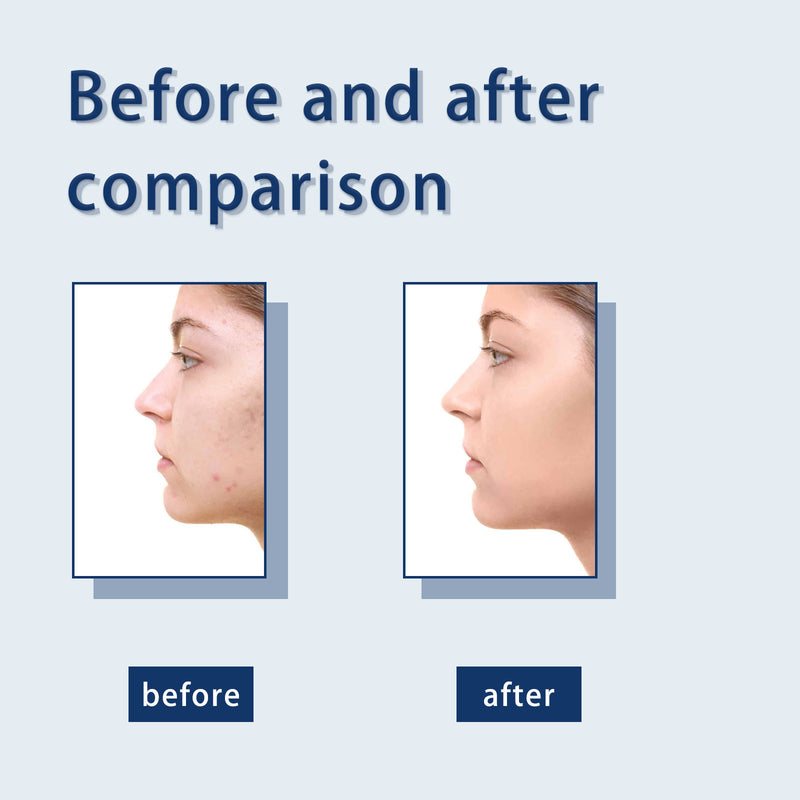 a woman's nose before and after comparison