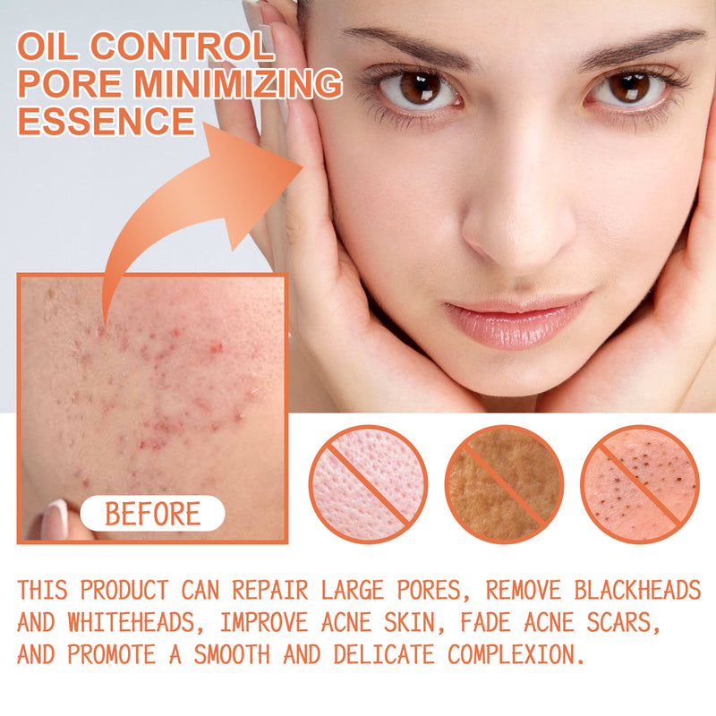 OUHOE Oil Control Pore minimizing Essence