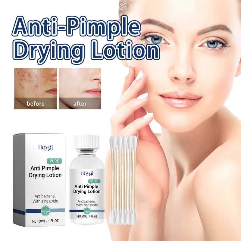 a woman with a bottle of anti pimple drying lotion